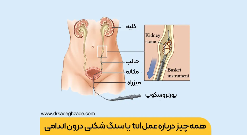 عمل tul