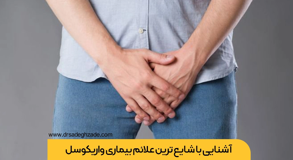 علائم واریکوسل شایع