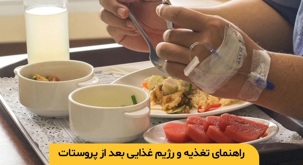 رژیم غذایی بعد از پروستات