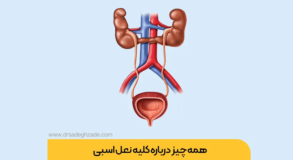 عکس کلیه نعل اسبی