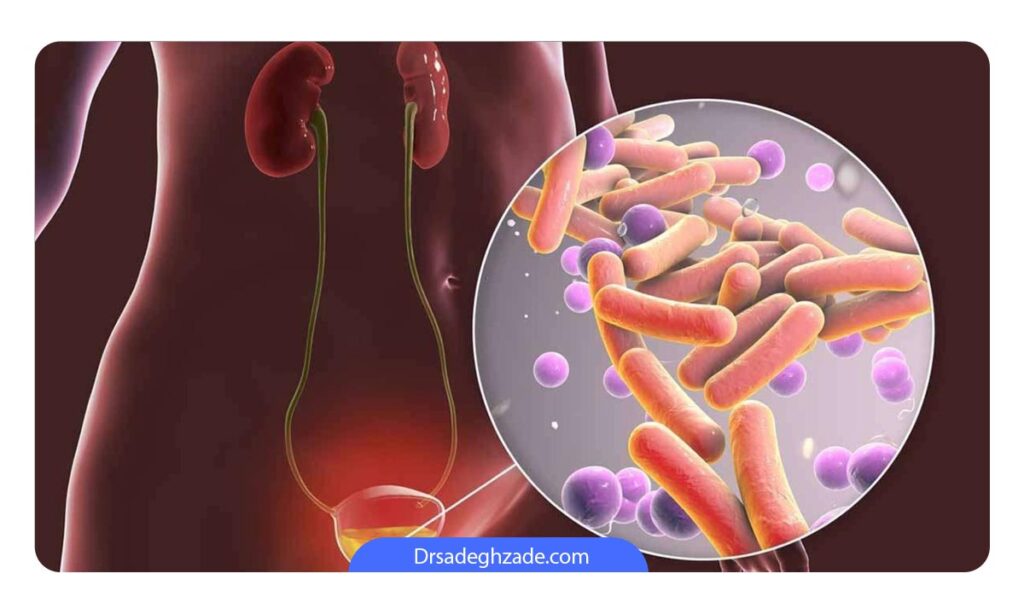 عفونت دستگاه ادراری 