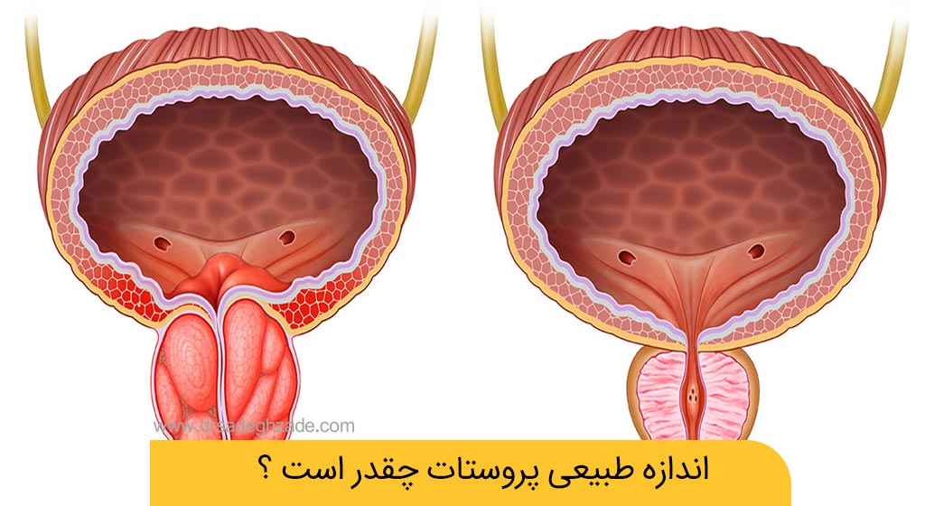 اندازه طبیعی پروستات چقدر است