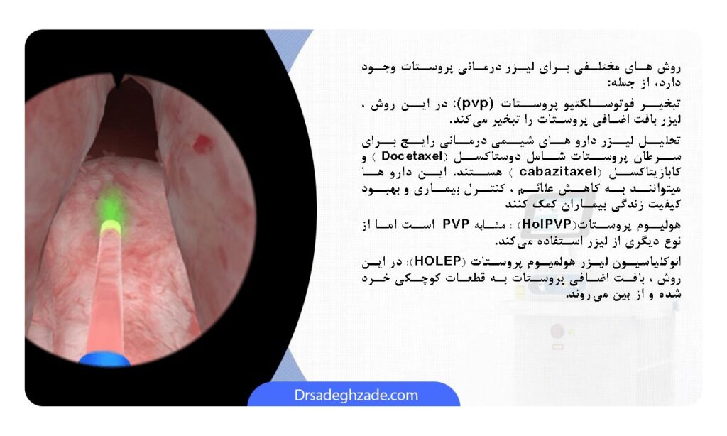 تصویر اینفوگرافی درباره شیمی درمانی پروستات 