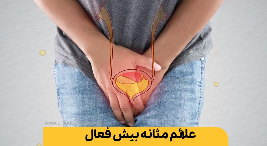 مثانه بیش فعال