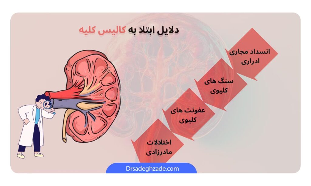 تصویر اینفوگرافیک از دلایل ابتلا به کالیس کلیه