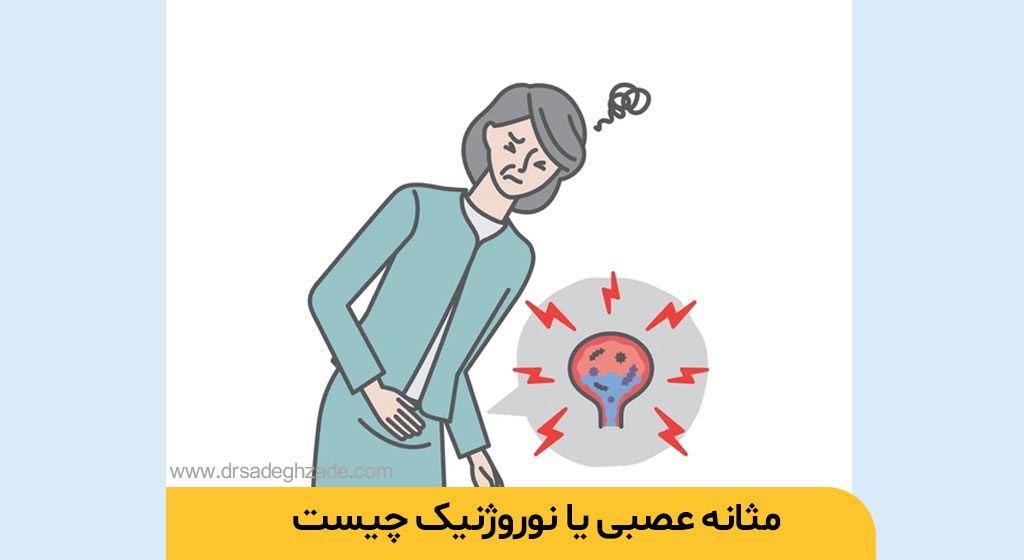 مثانه عصبی یا نوروژنیک